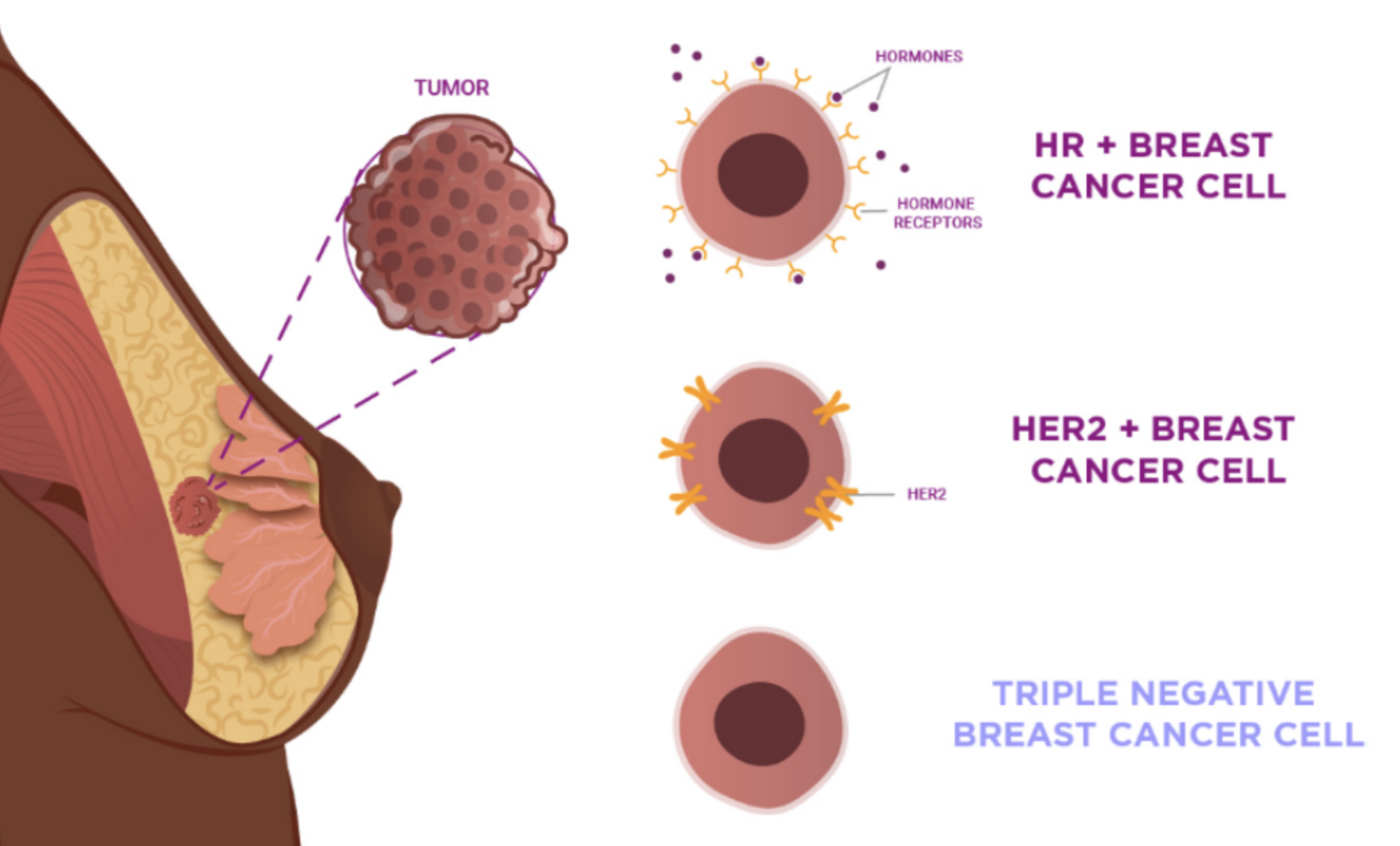 Cancer Cell Types
